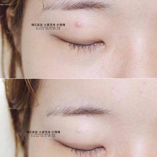 [Auth] CHE KHUYẾT ĐIỂM THE SAME