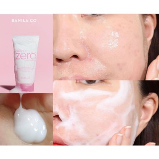 Sữa rửa mặt BANILA CO Clean It Zero Foam Cleanser 150ml