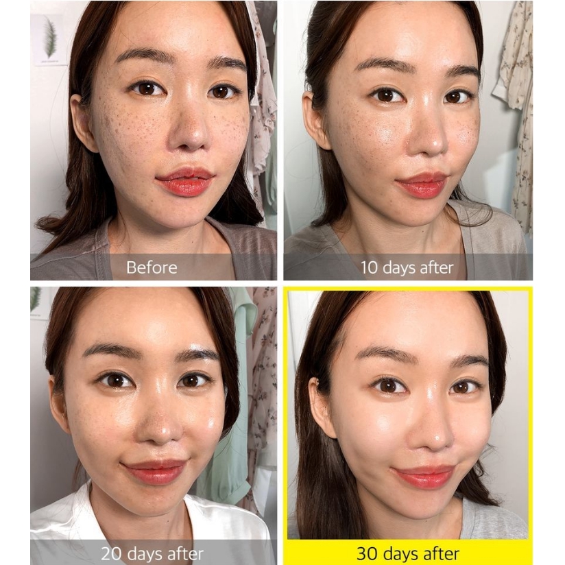 Tinh Chất Dưỡng Trắng Da Some By Mi Yuja Niacin 30 Days Blemish Care Serum