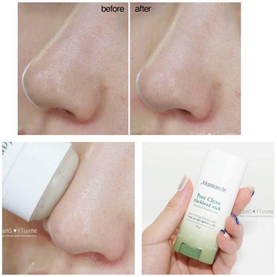 Sáp Giảm Mụn FREESHIP Sáp mụn Mamonde Pore Clean Blackhead Stick giảm mụn đầu đen hiệu quả Hàn Quốc