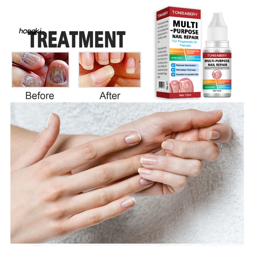 Dung Dịch Dưỡng Móng Chân Kháng Khuẩn Phục Hồi Móng Chân