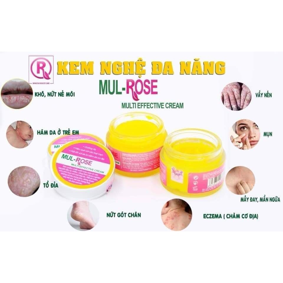 Kem dưỡng da Mulrose, thành phần thiên nhiên 100%, không chứa Corticoid gây hại cho da