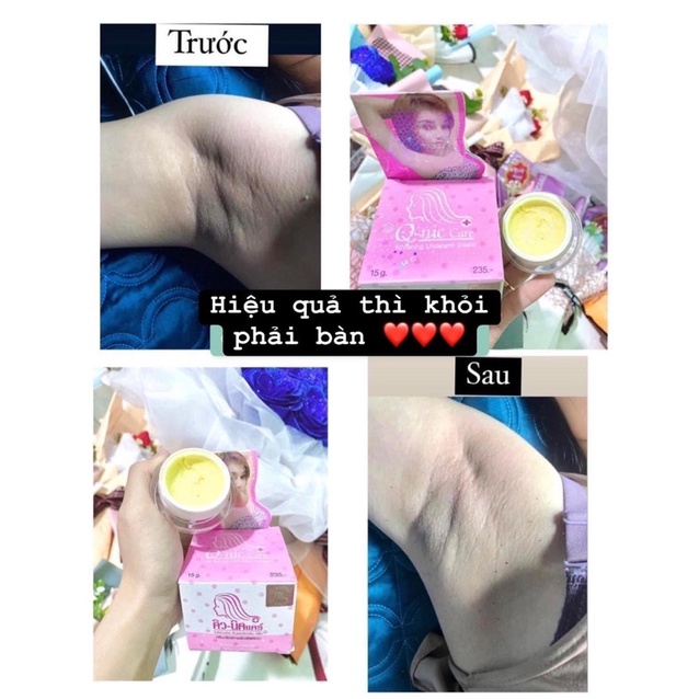 Kem giúp giảm Thâm Nách, Thâm Mông, Thâm vùng Bikini Qnic Loại To
