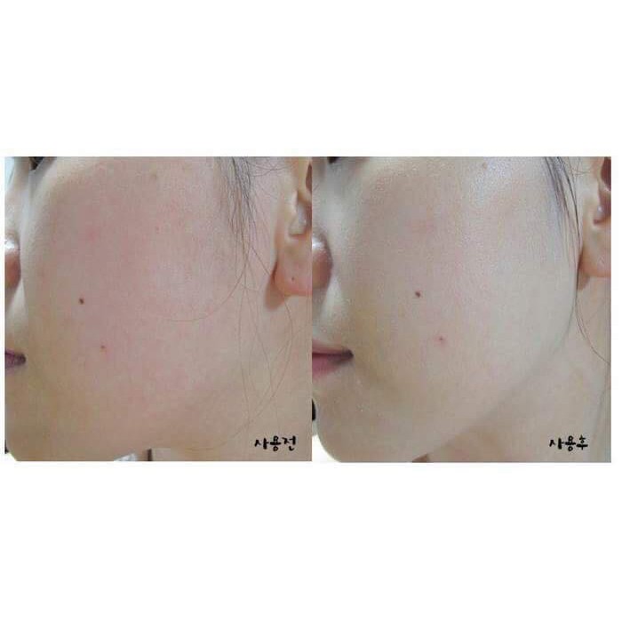 Kem ốc sên Premium Snail Tone Up Cream Goodal