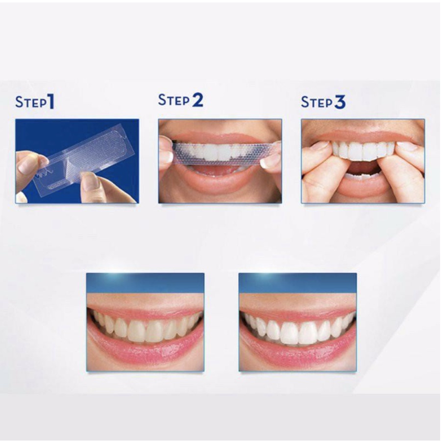 Miếng Dán Trắng Răng 3D - 5D White An Toàn, Hiệu Quả chỉ sau 7-14 ngày
