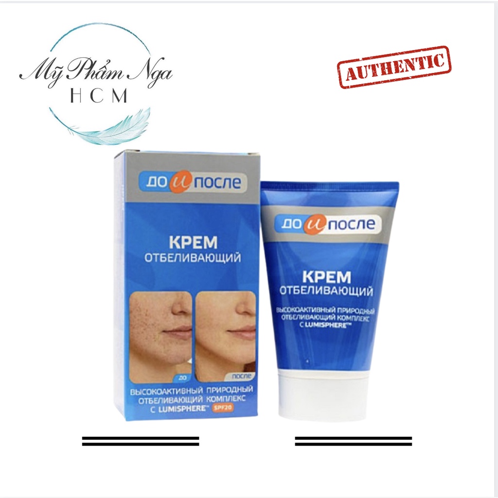 Kem nám Kpem Nga - Kem giảm nám trắng da Nga