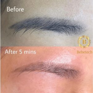 Máy laser xoá xăm tr.ị nám K4 Chính Hãng