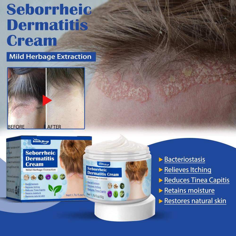 Kem Dưỡng Da Mặt South Moon Seborrheic Hỗ trợ giảm mụn Trứng Cá Ngứa Phục Hồi Da