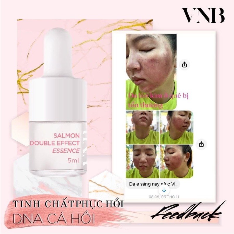 [Chính Hãng ] Serum Phục Hồi Da VNB 𝐒𝐀𝐋𝐌𝐎𝐍 𝐃𝐎𝐔𝐁𝐋𝐄 𝐄𝐅𝐅𝐄𝐂𝐓 𝐄𝐒𝐒𝐄𝐍𝐂𝐄