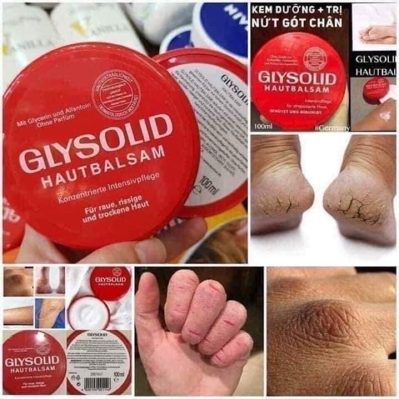 Kem nẻ gót chân Glysolid Hautbalsam chống da khô nứt nẻ, 100ml