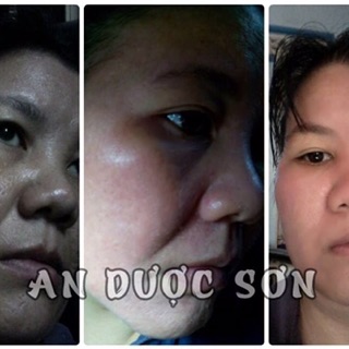 an dược sơn 50ml và bột rửa mặt
