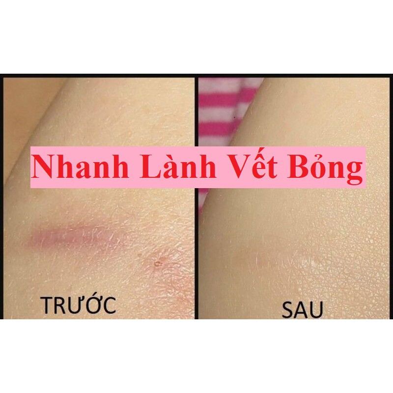 Mỡ Trăn Nguyên Chất N'Store Mỡ Trăn Triệt Lông