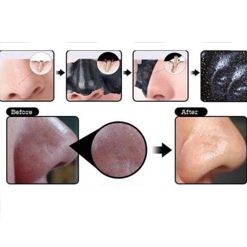 Gel loại bỏ mụn đầu đen làm sáng da YUK