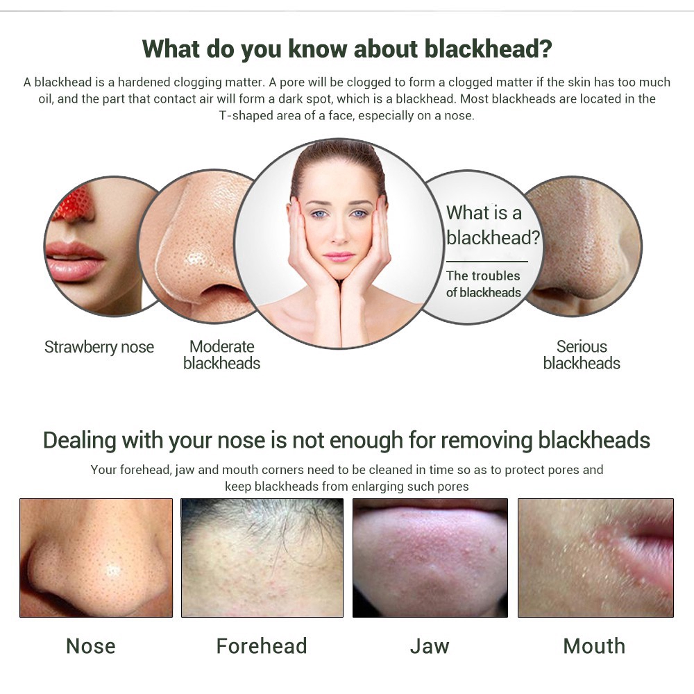 LANBENA mặt nạ lột mụn đầu đen mũi blackhead mask mặt nạ lột mụn than tre 50g