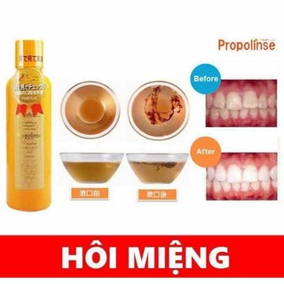 NƯỚC SÚC MIỆNG “THẦN THÁNH” PROPOLINE NHẬT BẢN