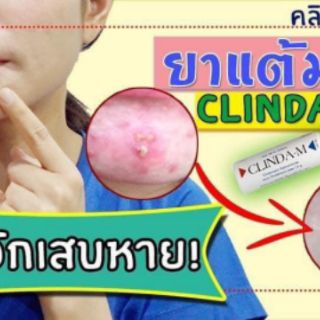 CHẤM MỤN CLINDA-M Thái Lan TUÝP 15ml
