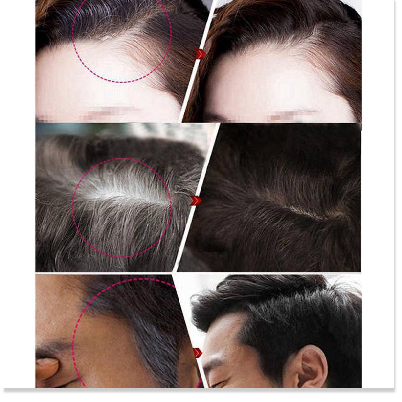 Nhuộm tóc tạm thời 🔖1 ĐỔI 1 🔖 Cây son nhuộm tóc Saion giúp che phủ tóc bạc nhanh chóng, an toàn cho da đầu 8496 | BigBuy360 - bigbuy360.vn