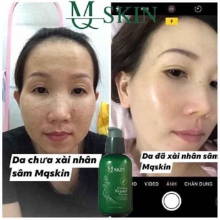Serum mskin nhân sâm