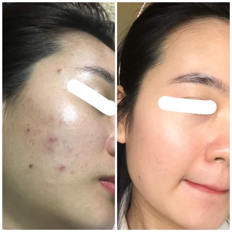 Thay Da Sinh Học Inno LIGHTENING 15g