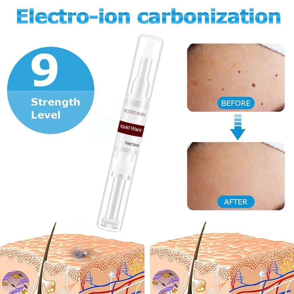 (Hàng Mới Về) Dung Dịch Loại Bỏ Mụn Thịt Nhanh Chóng 3ml | BigBuy360 - bigbuy360.vn