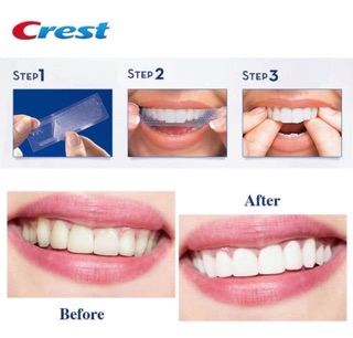 (Bill_sẵn) Miếng dán trắng răng crest Mỹ