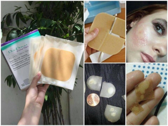 Miếng dán hút mụn Duoderm Extra Thin  - Chính hãng