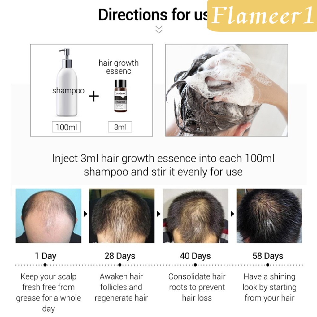 [Hàng mới về] Serum tinh dầu kích thích mọc tóc ngăn ngừa rụng tóc dành cho nam và nữ