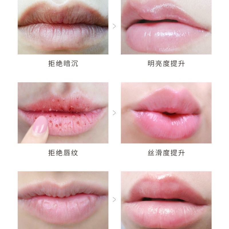 [Hàng mới về] Son môi Ichear hỗ trợ tẩy tế bào chết chăm sóc làn môi hiệu quả