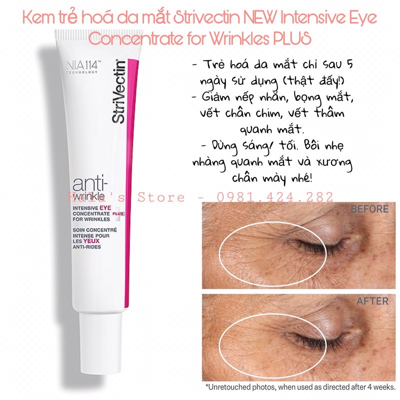 Strivectin ✨ Kem dưỡng mắt ngăn ngừa lão hóa cho mắt NEW Intensive Eye Concentrate for Wrinkles PLUS