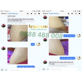 Combo 2 hộp trị rạn Arganan