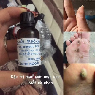 Dung dịch acid trichloracetic 80% 15ml loại bỏ các loại mụn cóc mụn cơm - ảnh sản phẩm 2