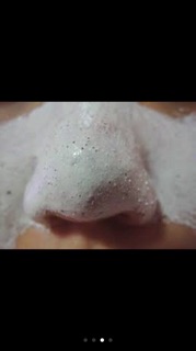 Kem lột mụn cao cấp