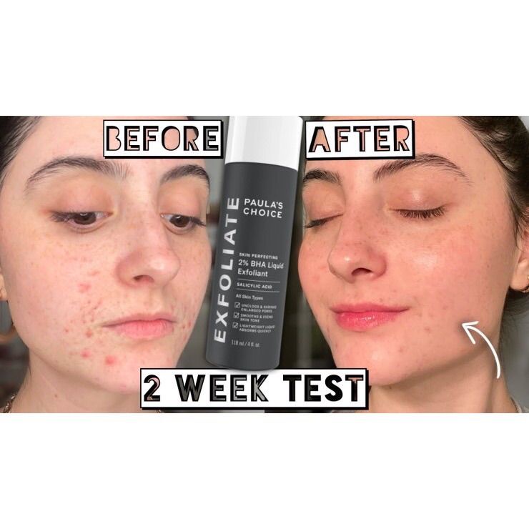 Dung dịch loại bỏ tế bào chết Paula’s Choice Skin Perfecting 2% BHA Liquid Exfoliant 118 ml Làm sạch lỗ chân lông, cải thiện mụn trứng cá, mụn đầu đen