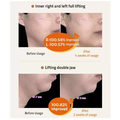 MISSHA Serum Dưỡng Da Nâng Cơ Chống Lão Hóa Và Nếp Nhăn Time Revolution Prime stem 100 50ml