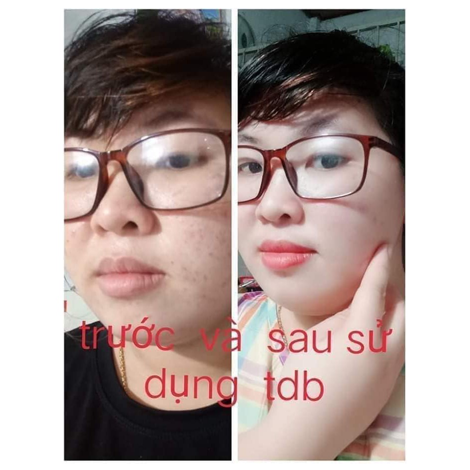 TINH DẦU BƠ LAVI 100% NGUYÊN CHẤT NHÀ LÀM