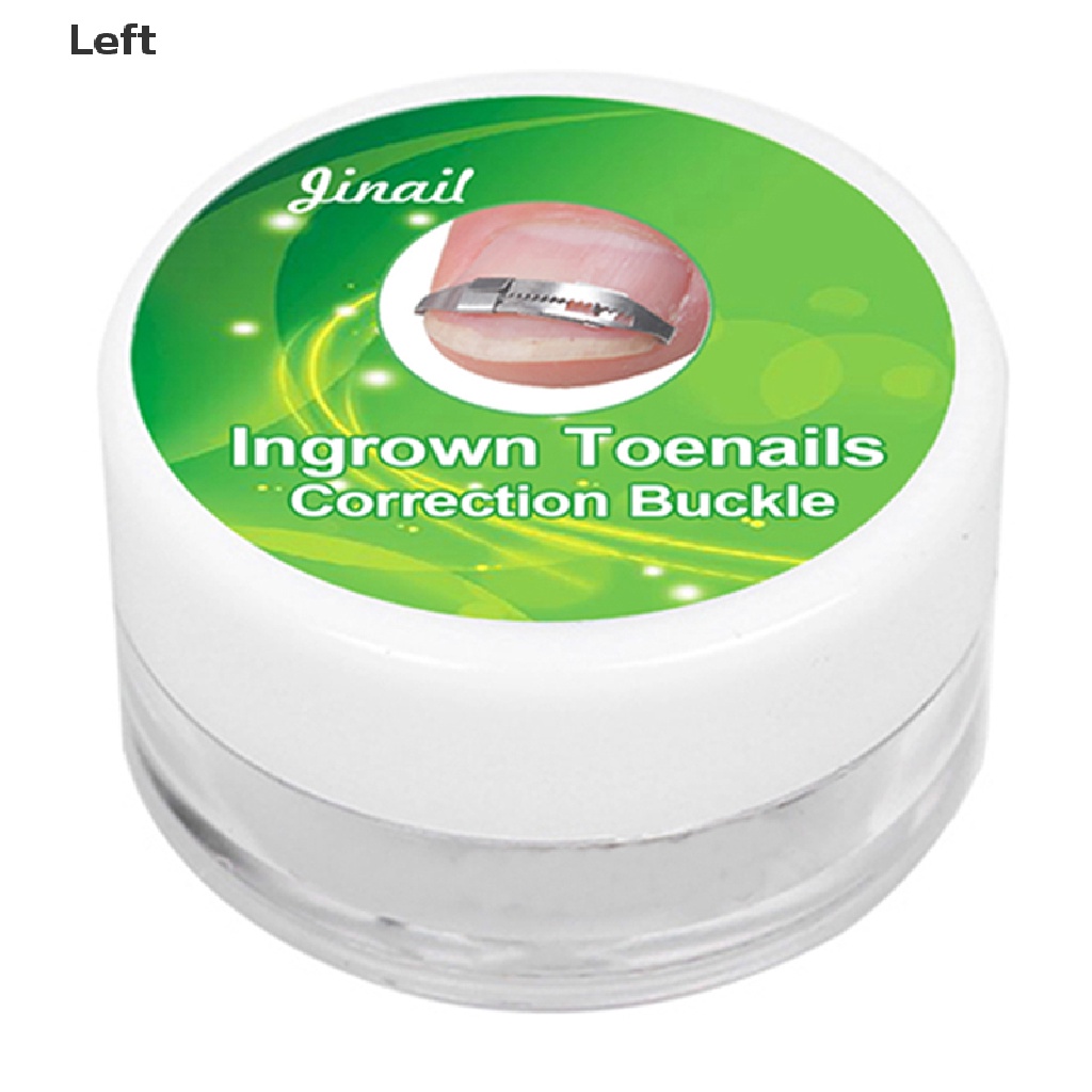 [Hàng mới về] 1 miếng dán chỉnh sửa móng chân mọc ngược