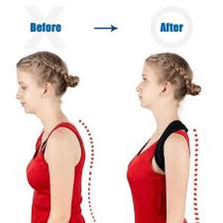 Đai lưng chống gù cao cấp