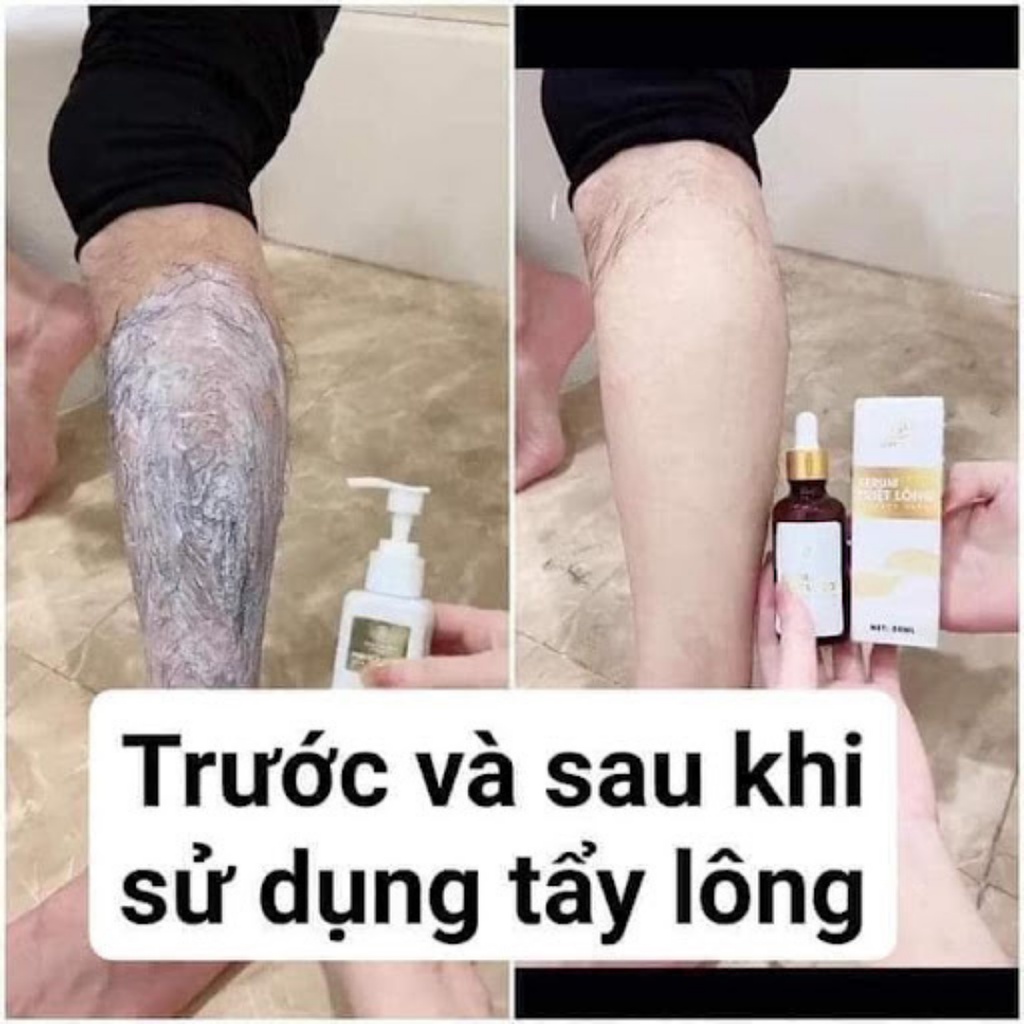 Kem tẩy lông huyền phi _ tặng kèm serum triệt lông vĩnh viễn an toàn cho làn da mềm mại