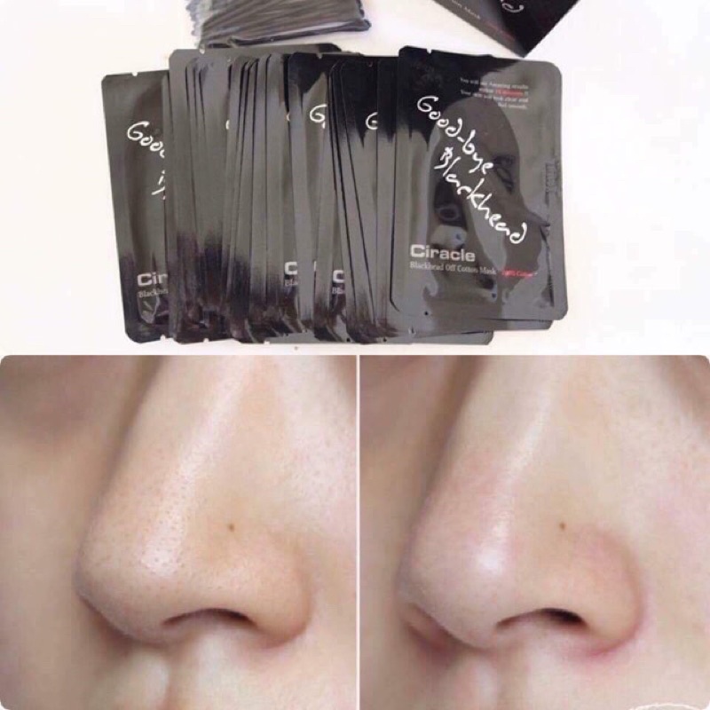 Miếng dán đẩy mụn đầu đen Goodbye Blackhead Ciracle