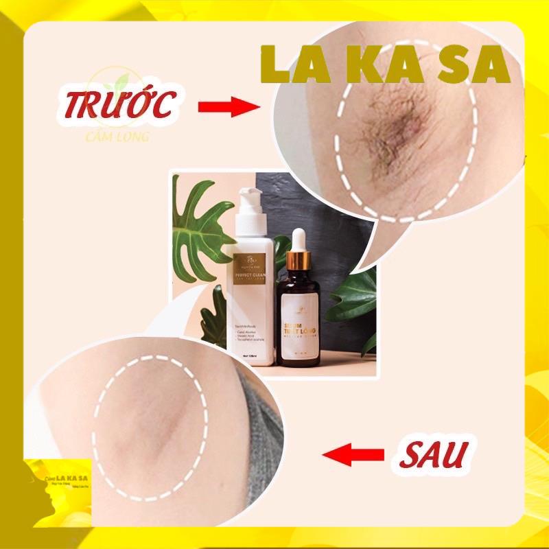 Kem Tẩy Lông Huyền Phi - Triệt Sạch Bất Chấp Các Loại Lông Tặng Kèm Serum