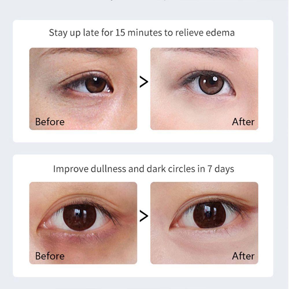 OCEANMAP Gel Eye Mask Dark Circles Remove 3Pair Hydrating Anti Aging Eye Puffiness Firming Anti-Wrinkle Eye Patches