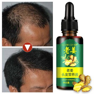 [Hàng mới về] Thuốc kích thích mọc tóc với tinh chất gừng tiện lợi