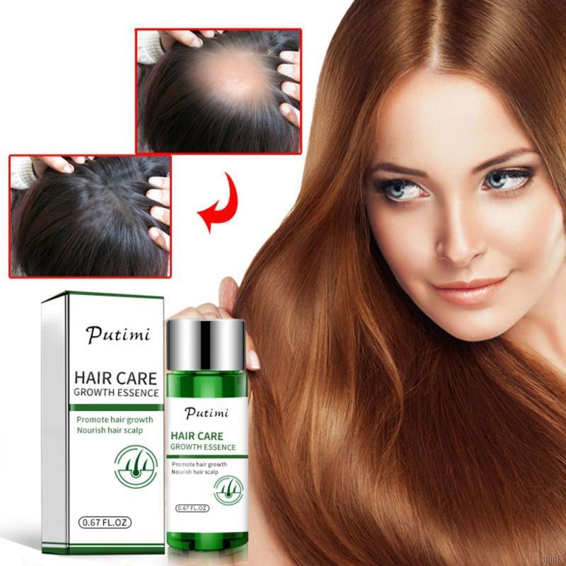 Tinh Chất Kích Thích Mọc Tóc Nuôi Dưỡng Da Đầu Chống Rụng Tóc