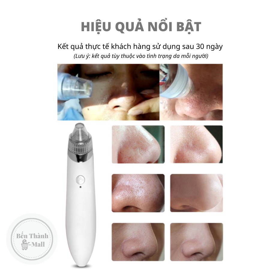 ✈️[Freeship] Máy hút mụn siêu mạnh cao cấp So Simple XN-8030 [Lực hút cực mạnh]