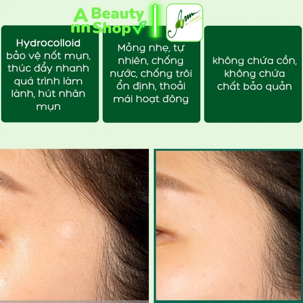 Miếng Dán Mụn Some By Mi Clear Spot Patch