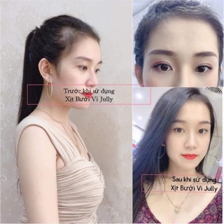 COMBO 3 CHAI TINH DẦU BƯỞI KÍCH MỌC TÓC ( tặng quà hấp dẫn )
