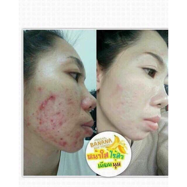 Gói ủ mặt ġiảm mụȵ Bannana Milk Powder 3 in 1 (White plus renew) Thái Lan