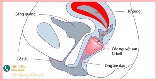 Cốc nguyệt san Sibell plus nhập khẩu. Tặng cốc tiệt trùng, viên tiệt trùng, cọ vệ sinh cốc.