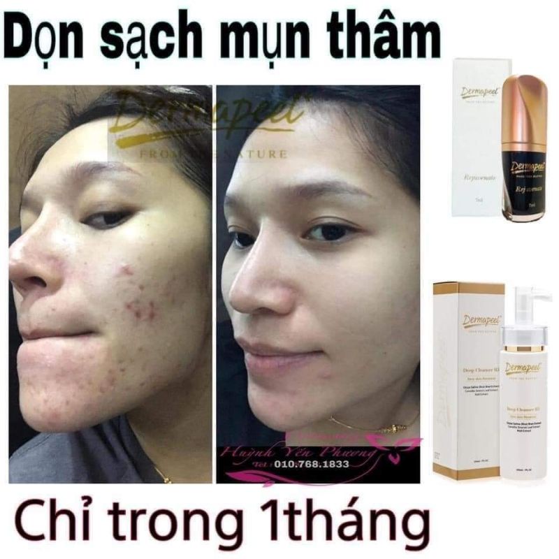 SỮA RỬA MẶT DERMAPEEL