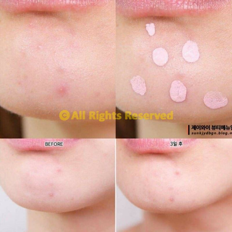 (XẢ KHO) (Date 08-2022) Dung dịch chấm mụn Mediheal A-Zero Shot Skin Control Pink Dressing | BigBuy360 - bigbuy360.vn